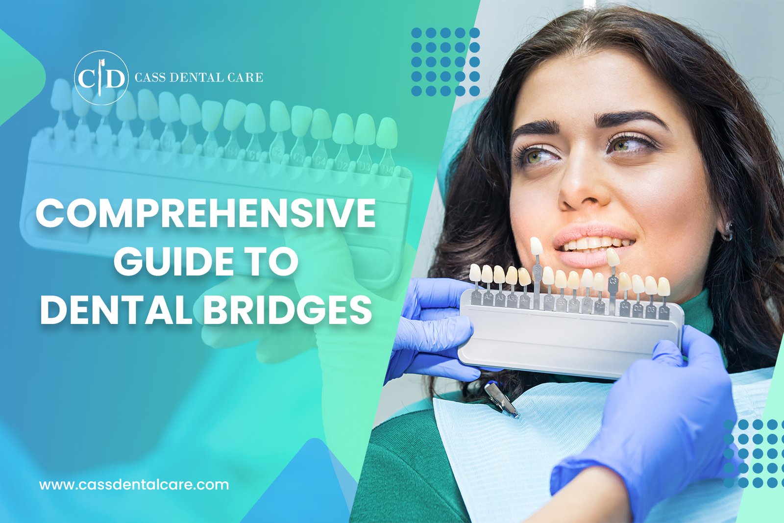 Comprehensive Guide to Dental Bridges (1)