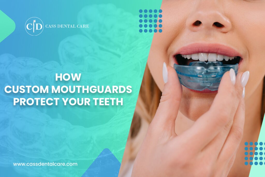 Best Custom Mouthguards for Teeth Protection