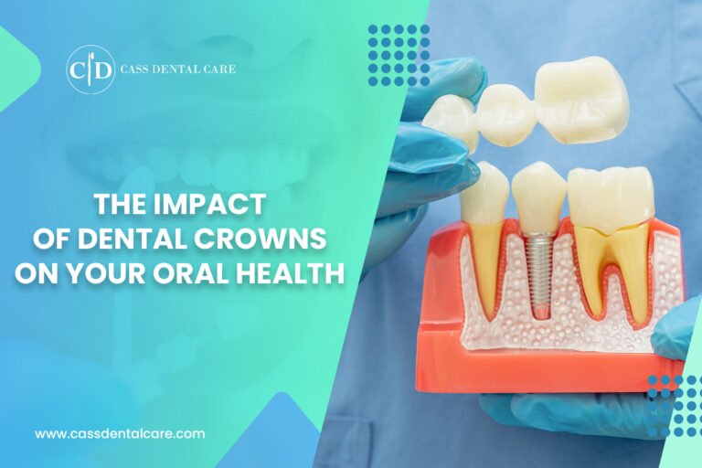 The Impact of Dental Crowns on Your Oral Health