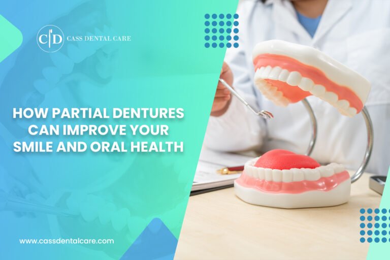 How Partial Dentures Can Improve Your Smile and Oral Health