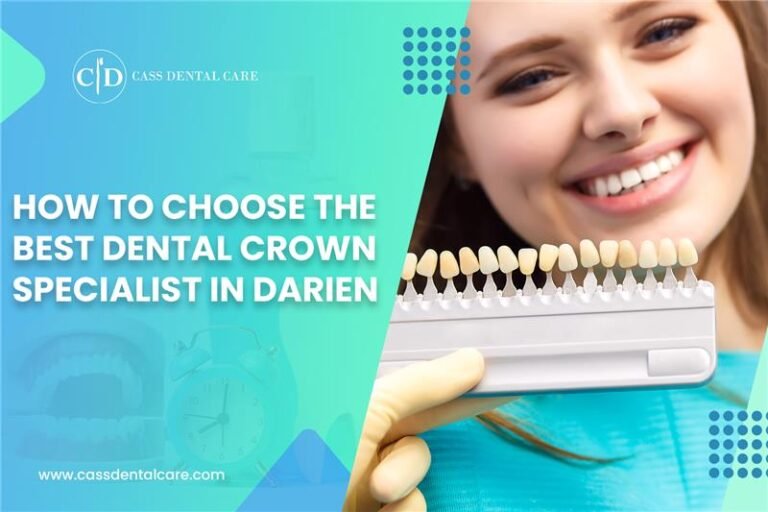 How to Choose the Best Dental Crown Specialist in Darien