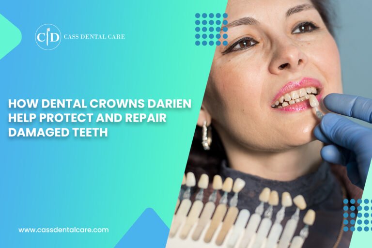 Dental Crowns Darien
